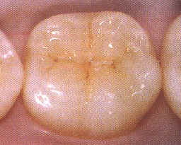 Sealent1 (1).jpg (60726 octets)